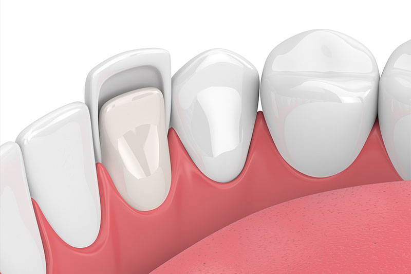 Cosmetic Dentistry in Houston