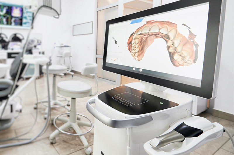 Itero Intra-oral Scanner in Houston